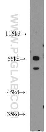 STAM2 Antibody in Western Blot (WB)