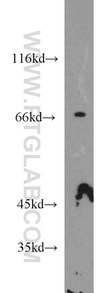 STAM2 Antibody in Western Blot (WB)