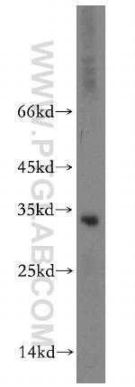RPIA Antibody in Western Blot (WB)
