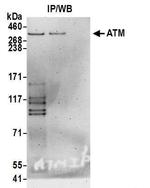 ATM Antibody in Western Blot (WB)
