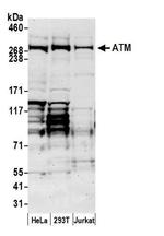 ATM Antibody in Western Blot (WB)