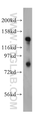 EPB41 Antibody in Western Blot (WB)