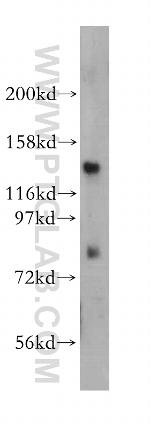 EPB41 Antibody in Western Blot (WB)