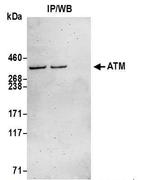 ATM Antibody in Western Blot (WB)