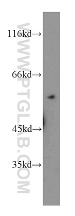 DBNL Antibody in Western Blot (WB)