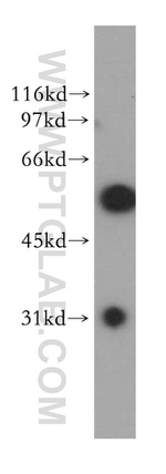 DBNL Antibody in Western Blot (WB)