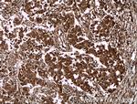 DBNL Antibody in Immunohistochemistry (Paraffin) (IHC (P))