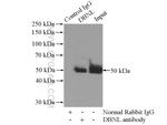 DBNL Antibody in Immunoprecipitation (IP)