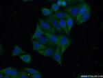 MMP23B Antibody in Immunocytochemistry (ICC/IF)