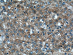 MMP23B Antibody in Immunohistochemistry (Paraffin) (IHC (P))