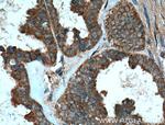 MMP23B Antibody in Immunohistochemistry (Paraffin) (IHC (P))