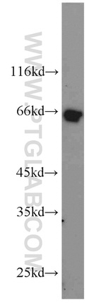 MMP23B Antibody in Western Blot (WB)