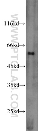 MMP23B Antibody in Western Blot (WB)