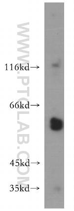 MMP23B Antibody in Western Blot (WB)