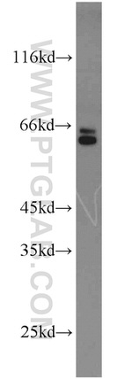 MMP23B Antibody in Western Blot (WB)