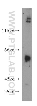 MMP23B Antibody in Western Blot (WB)