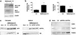 beta Amyloid Antibody in Western Blot (WB)