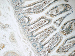 L-Plastin Antibody in Immunohistochemistry (Paraffin) (IHC (P))