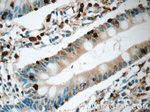 L-Plastin Antibody in Immunohistochemistry (Paraffin) (IHC (P))