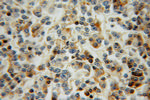 L-Plastin Antibody in Immunohistochemistry (Paraffin) (IHC (P))