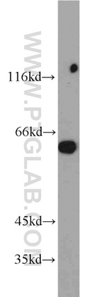 L-Plastin Antibody in Western Blot (WB)