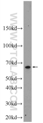 L-Plastin Antibody in Western Blot (WB)