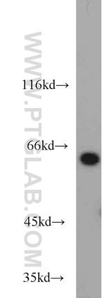 L-Plastin Antibody in Western Blot (WB)