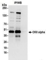 CKII alpha Antibody in Western Blot (WB)