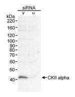 CKII alpha Antibody in Western Blot (WB)