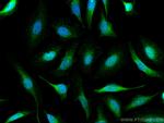 STAT4 Antibody in Immunocytochemistry (ICC/IF)