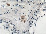 STAT4 Antibody in Immunohistochemistry (Paraffin) (IHC (P))