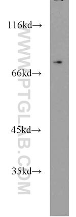 STAT4 Antibody in Western Blot (WB)