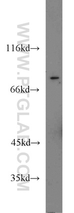 STAT4 Antibody in Western Blot (WB)