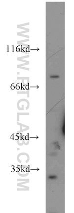 STAT4 Antibody in Western Blot (WB)