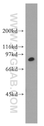 STAT4 Antibody in Western Blot (WB)