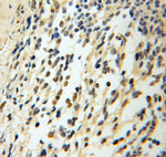 CHTF18 Antibody in Immunohistochemistry (Paraffin) (IHC (P))