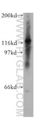 CHTF18 Antibody in Western Blot (WB)