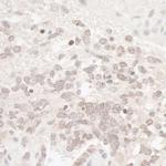 CKII alpha Antibody in Immunohistochemistry (IHC)