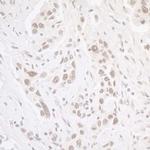 CKII alpha Antibody in Western Blot (WB)