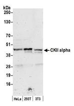 CKII alpha Antibody in Western Blot (WB)