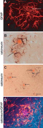 GFAP Antibody in Immunohistochemistry (IHC)