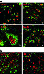 GFAP Antibody in Immunohistochemistry (IHC)