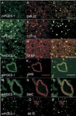 GFAP Antibody in Immunohistochemistry (IHC)