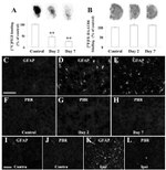 GFAP Antibody in Immunocytochemistry (ICC/IF)