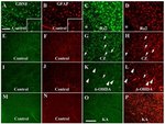 GFAP Antibody in Immunocytochemistry (ICC/IF)