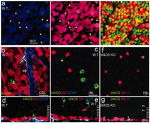 GFAP Antibody in Immunohistochemistry (IHC)