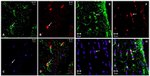 GFAP Antibody in Immunohistochemistry (IHC)