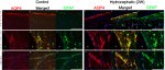 GFAP Antibody in Immunohistochemistry (IHC)