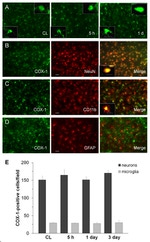 GFAP Antibody in Immunohistochemistry (IHC)