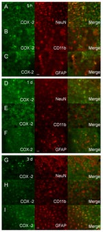 GFAP Antibody in Immunohistochemistry (IHC)